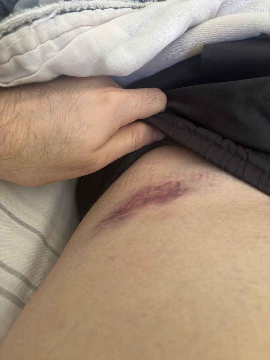 Matheusrrsantos's tweet photo. Estao me chamando de fatura da nubank dps da luta de ontem detalhe que eu ganhei essa buceta o motivo ai https://t.co/yhMwSBLL05