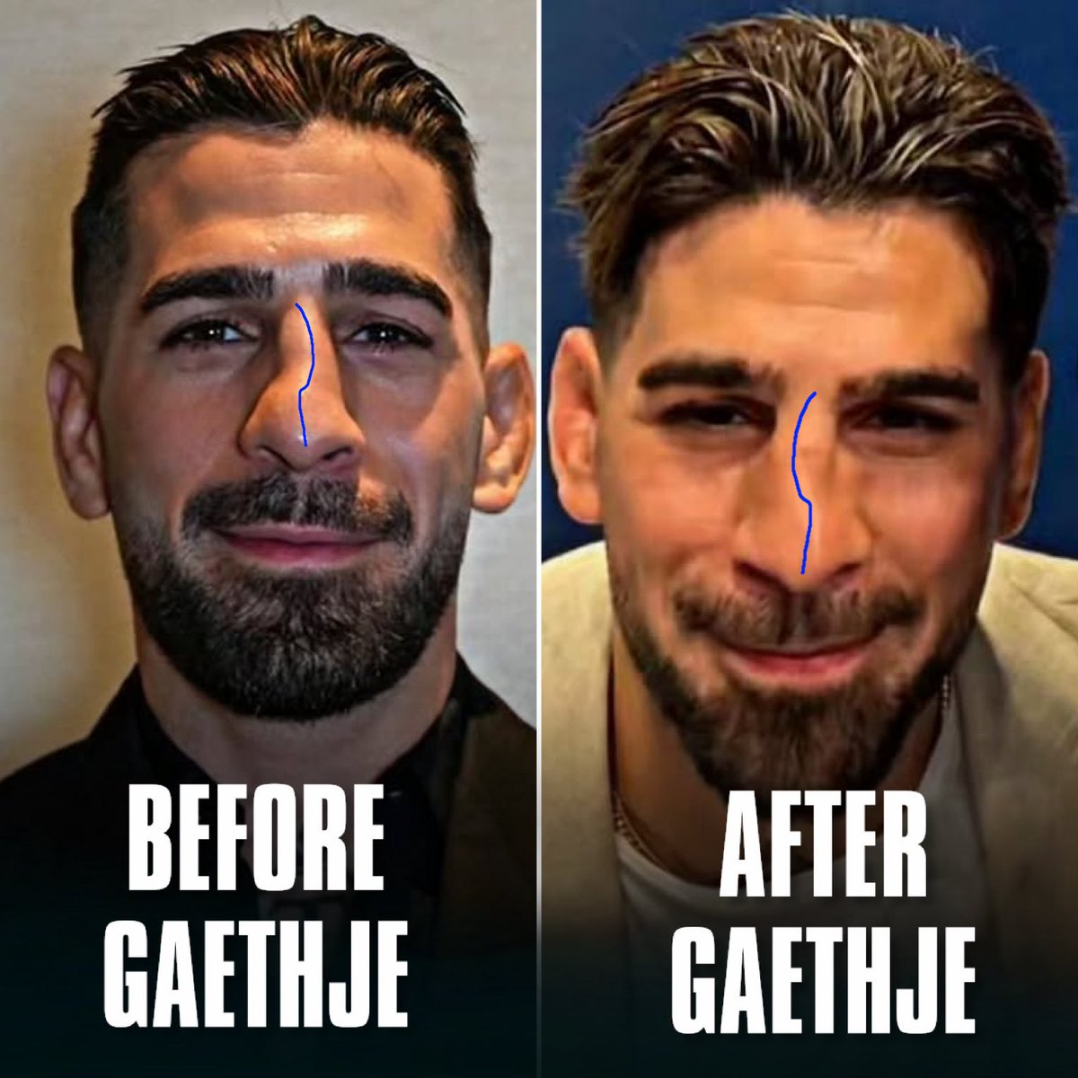 zepperos's tweet photo. @lefthookclub are the images mirror or did justin really swap his already bent nose to bend the other way https://t.co/DJaYKRDSss
