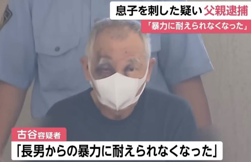 aigare01's tweet photo. 【悲報】76歳父親、52歳息子を包丁で何度も刺し逮捕

千葉県で「息子からの暴力に耐えられなかった」と
父親が息子を刺し、自殺を図るも
殺人未遂の疑いで逮捕

しかし父親の顔には痛々しいあざが
ネットでは”息子を逮捕しろ”との同情の声 https://t.co/w3Dz3AFcNs