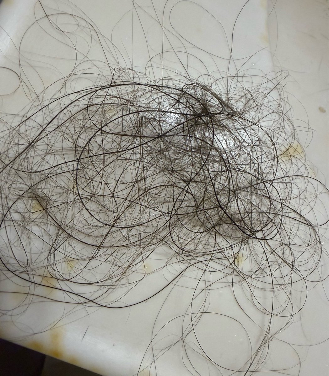 witchymilf222's tweet photo. any tips for postpartum hair loss ?! 😓 https://t.co/yugwEi3j6f
