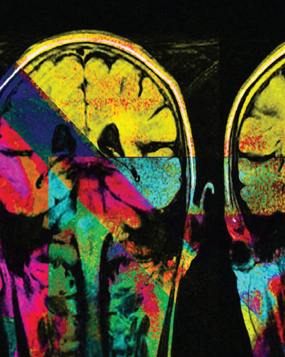A vibrant and colorful abstract representation of a brain scan with overlapping geometric shapes in a spectrum of colors including yellow, blue, pink, and green.