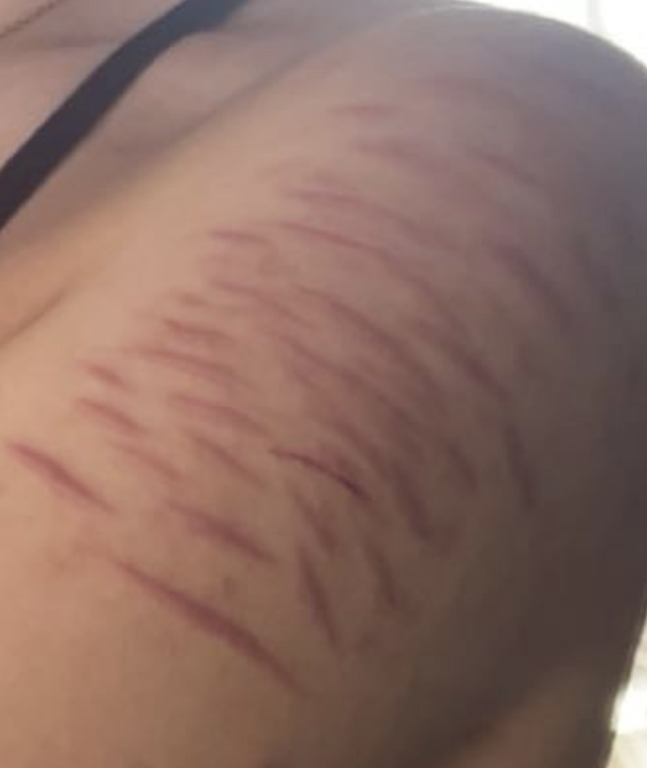 anvilsung's tweet photo. ‼️SFX MAKEUP ‼️ fuckk my forearm scars used to look so good #shedtwt #slittwt #988twt https://t.co/NVKVPyMiKK