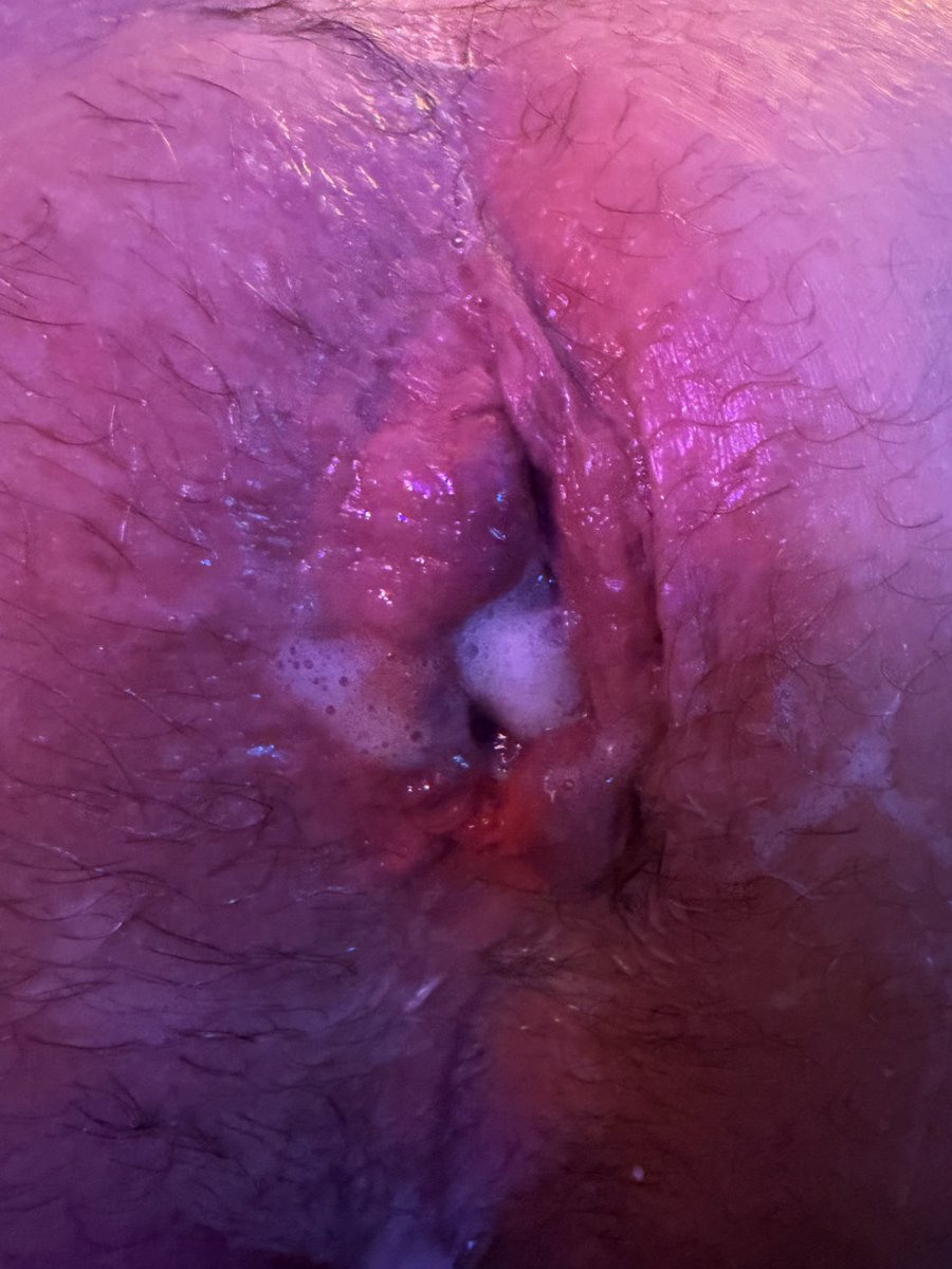 GeekyDeviant's tweet photo. GREAT session this afternoon.
#ff #fisting #fisthole #fistpig #ffbottom #fistbottom #chastity #gaychastity #lockedbottom https://t.co/TXq5tSRhf0