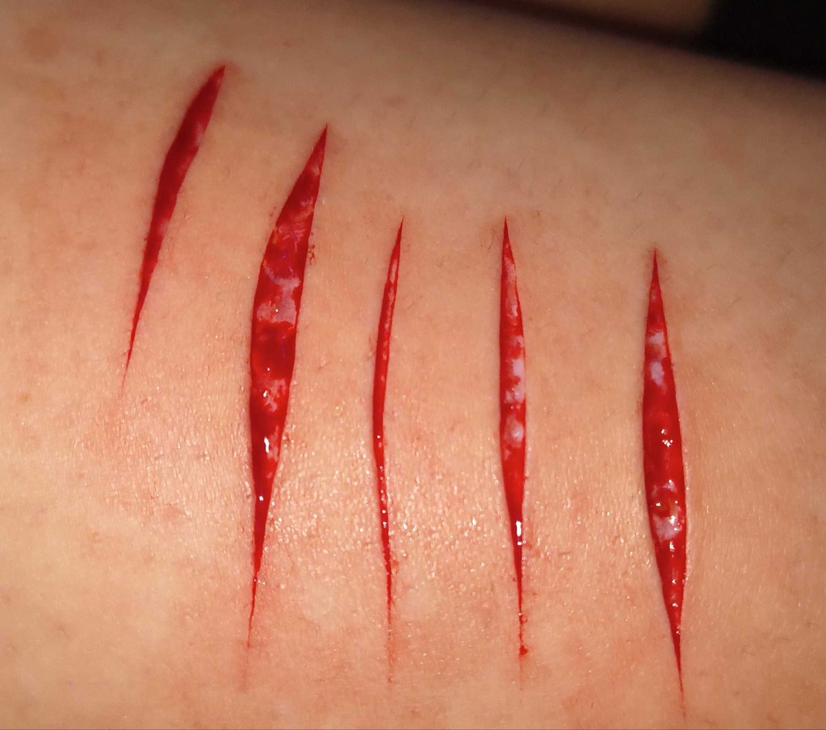 minaslimetime's tweet photo. Ouhh these hurt so bad, especially the ones on my calf bro😢 but thank u @rennislettuce for these, and thank u @aggressiveuke for being her emotional support while she did it🥰 #shtwt #slittwt https://t.co/w161972icd