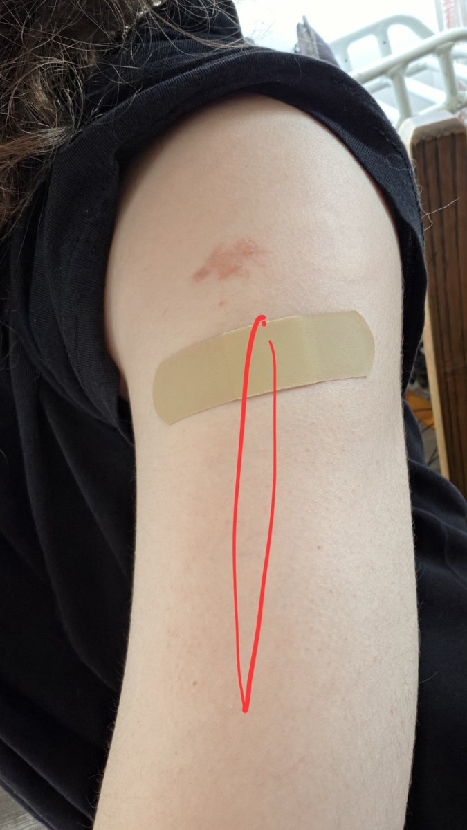 Caseyrelapsing's tweet photo. I wanted to do a cut like that in the next weeks but i dont wanna do it anymore https://t.co/DpfhAjZd8d