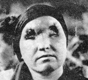 outsidersesp's tweet photo. El 23 de agosto de 1958 moría en Pula, Ístria, la partisana antifascista yugoslava Ruža Petrović.

Detenida por tropas fascistas italianas el 23 de julio de 1944, la torturaron brutalmente, la ataron a un árbol y le sacaron los dos ojos con un cuchillo. Pese a las brutales torturas a las que la sometieron jamás reveló los planes de la guerrilla antifascista ni delató a ni una sola de sus compañeras.

Honor y gloria eternas a las heroínas del pueblo y a las luchadoras contra el fascismo.