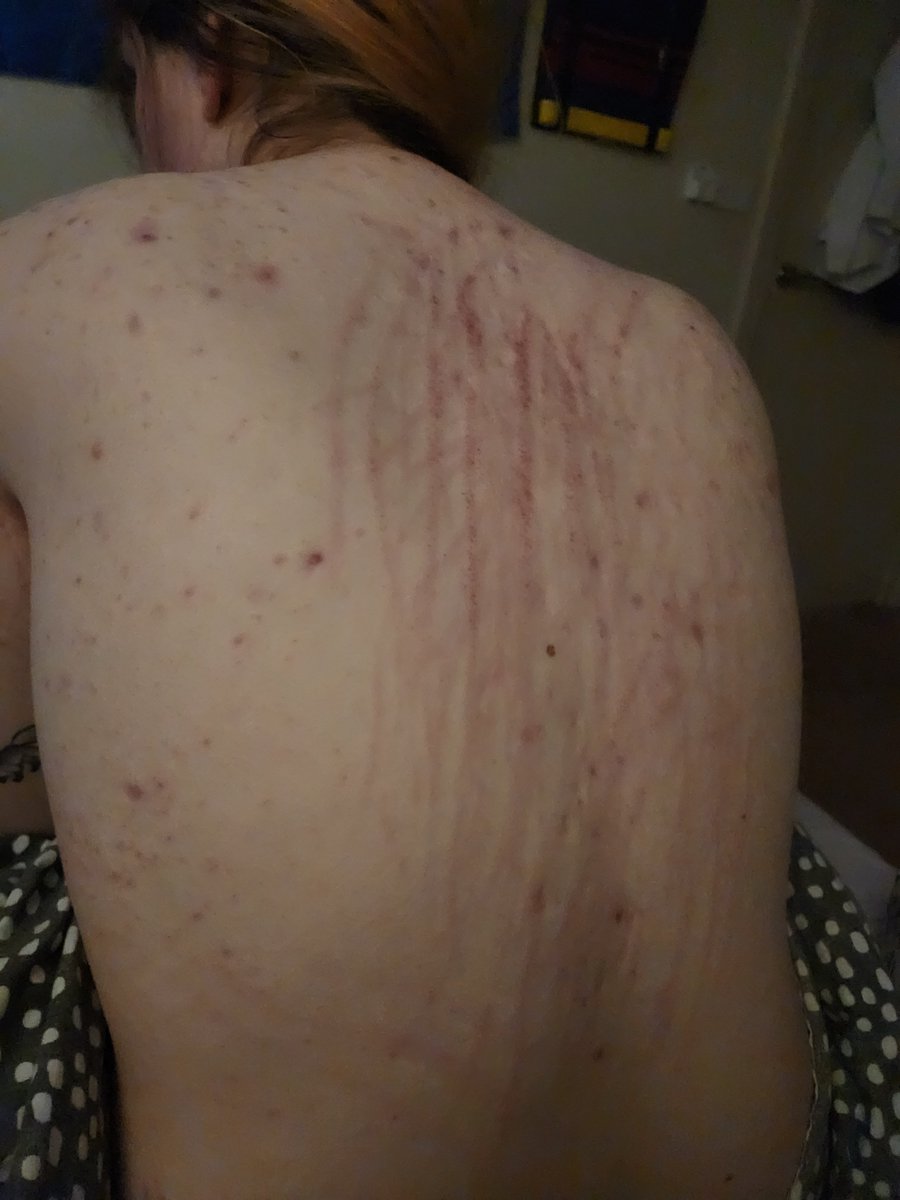 unholiercleo's tweet photo. Pretty girl it saw today left it with some pretty scratches https://t.co/JE1pErCVD8