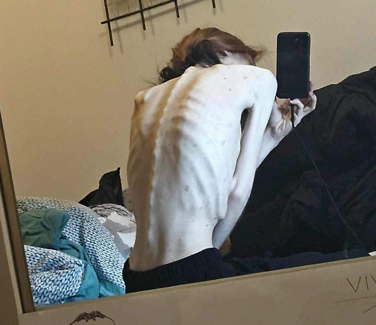 gothmonstercalz's tweet photo. tw / bodychecks
-
honestly i dont even know what im doing with my life anymore lmfao also i got the flue AGAIN https://t.co/dhD0UVCJ5c