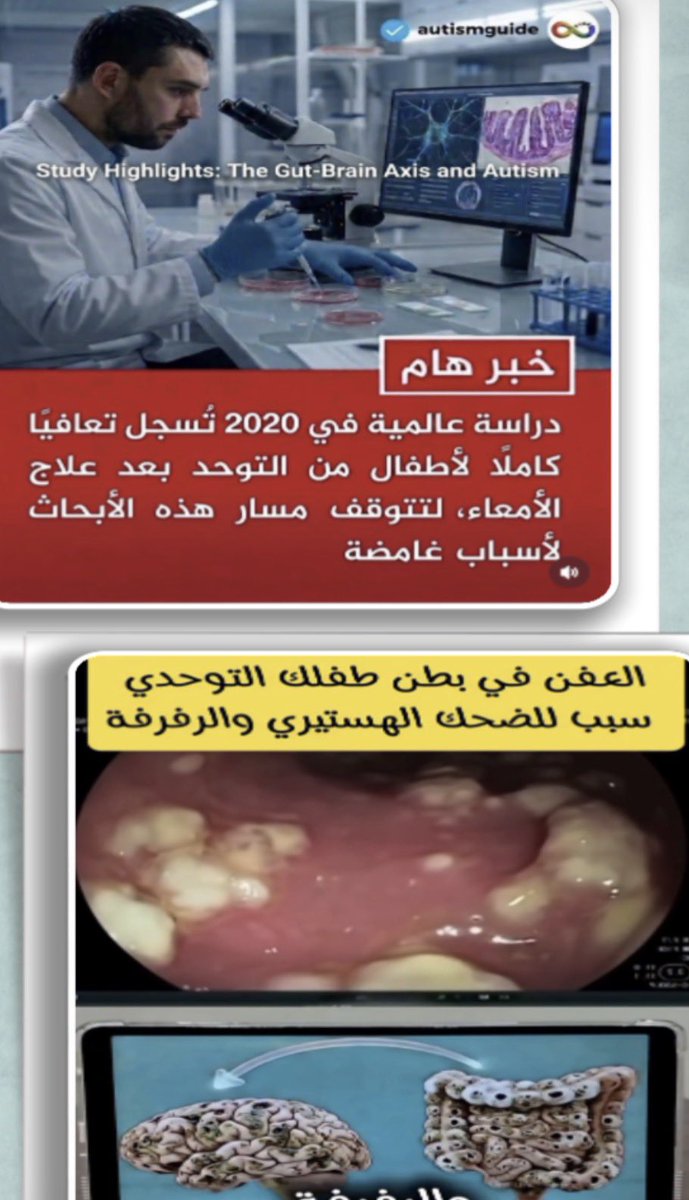 law_mudahka's tweet photo. التوحد

رحم الله الدكتور ضياء العوضي
التشافي باصلاح الجهاز الهضمي :
لقاحات
مضادات
اكل مرشوش 
هرمونات في غذاءك
الياف طويله صعبه التمثيل الغذائي والهضم.
لم يأت بجديد بل طور واضاف للفكره ومن ثم وضع لها نظام غذائي متكامل سهل بمتناول يد الكل الفقير قبل الغني . https://t.co/ChxiffR542