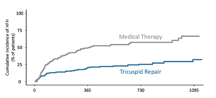 Felipediezhoyo's tweet photo. 📌 Lo más importante a mi juicio del estudio es que asienta el proof-of-concept del tratamiento pronóstico de la IT

🎯 En pacientes de alto riesgo (con IT severa, muy sintomáticos, ingreso reciente IC, ERC, fallo hepático) la IT juega un papel, y tratarla, ⬇️ EVENTOS, incluida ☠️, y desde muy pronto

Este estudio 📖 es el PARTNER B de la IT