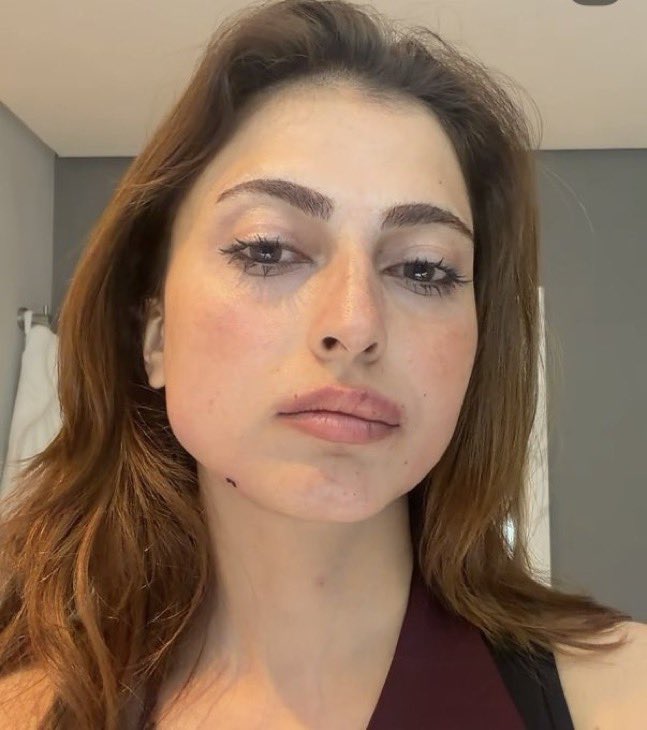 debserved's tweet photo. This was genuinely scary to watch😨 She won but we were all crying with you, Hana. 🥺❤️‍🩹 You fought through the pain and still finished it like a true Khiladi.

So proud of you 🫶🏻
ENDURE LIKE FARRHANA
#FarrhanaBhatt #FarrhanaRebellions #KKK15 https://t.co/W2pyQyYm5a