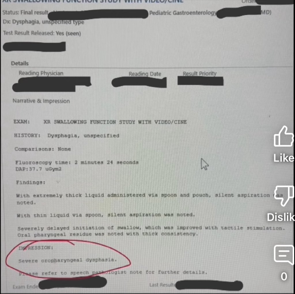 ohnonotapotato's tweet photo. I’m genuinely surprised more people didn’t talk about Jrs leaked medical records. 
Withdrawal Symptoms, Spasticity, Neurological Issues, Fetal Alcohol Syndrome, the list goes on😔
He needs PALLIATIVE CARE.

This Gaptooth McGoo, MADtv lookin ass bitch was doing lines while she was pregnant too🤦🏽‍♀️

#ChriseanRock #MustyMalone #SonnyDoe #SaveSonnyDoe #ChriseanJr #SaveJr #Chrisean