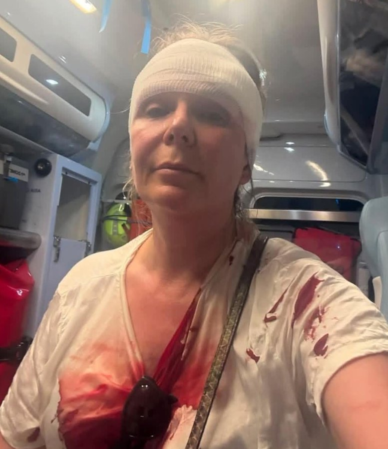 Lykten_no's tweet photo. Denne italienske kvinnen ble slått til blods av muslimske inntrengere fra Nord-Afrika fordi hun gikk tur med hunden sin, som anses som uren av muslimer. De stjal også smarttelefonen hennes. Hun fikk 14-dagers sykemelding.

Hvorfor må vi leve slik?
#Remigrasjon https://t.co/OHwp0qByP6