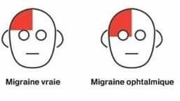 enjingirlfie's tweet photo. Dieu merci oui je fais la puriste des migraines mais j’affirme que 98% des gens ne savent PAS ce qu’est une migraine et confonde ça avec des céphalées de tension et ça me rend FOU prck la migraine (la vrai) est le HANDICAP le + répandu oui c un réel handicap reconnu par la mdph, https://t.co/FTl0hjZusG