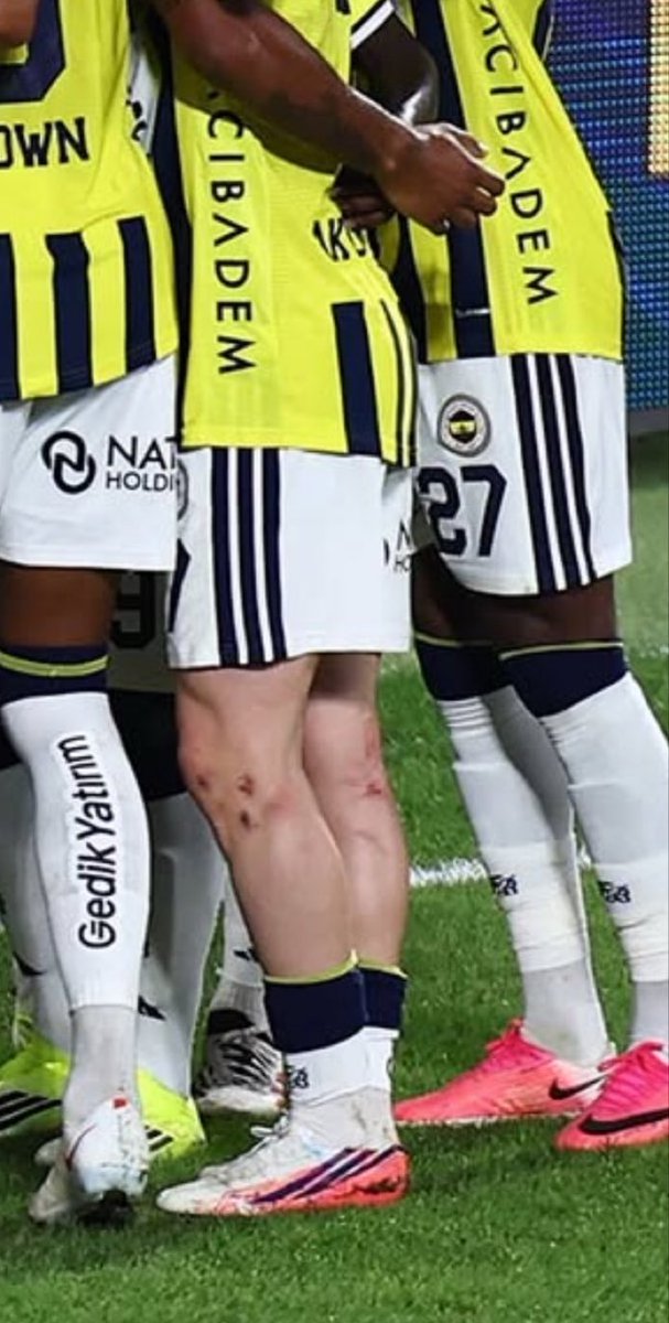 NuribeFb_100's tweet photo. Konyasporlu Uğurcan’ın yaptığı müdahaleler sonucunda Kerem’in bacaklarının son hali.

Geçen sene Archie Brown’u sakatladı. Kerem’in hastanelik etti. Dizini delik deşik etti. Tek kart görmedi. https://t.co/PtYUcspAxf