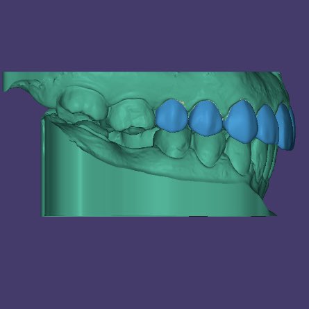NfwUf's tweet photo. Every smile starts with a plan. 🦷💙 https://t.co/ARbDLvBWw7