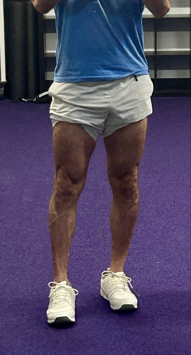 MikeNMeatt's tweet photo. Sunday leg day!
#DoWorkSon https://t.co/y9aMJPD4c7
