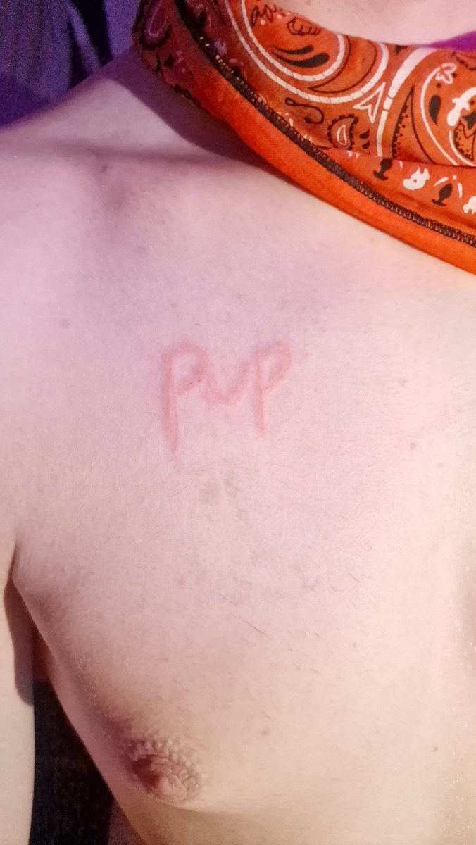 sprocket_foxi's tweet photo. Theres plenty nore room what would u write 🤔😈
#badboy #naughtypup #ukpup #scratched https://t.co/xXXyr2RQlO