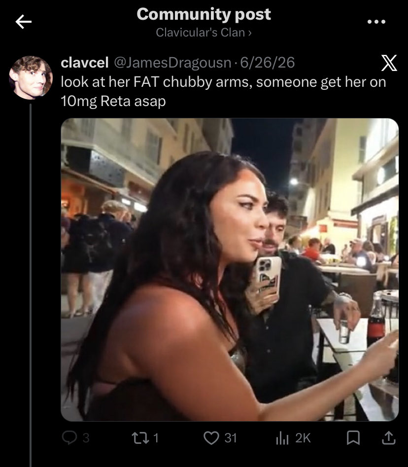 LegsOfClav's tweet photo. @JamesDragousn @Clavicular0 You are gay and fatherless, like every one of his other homo fans https://t.co/HU1cYEhJ28
