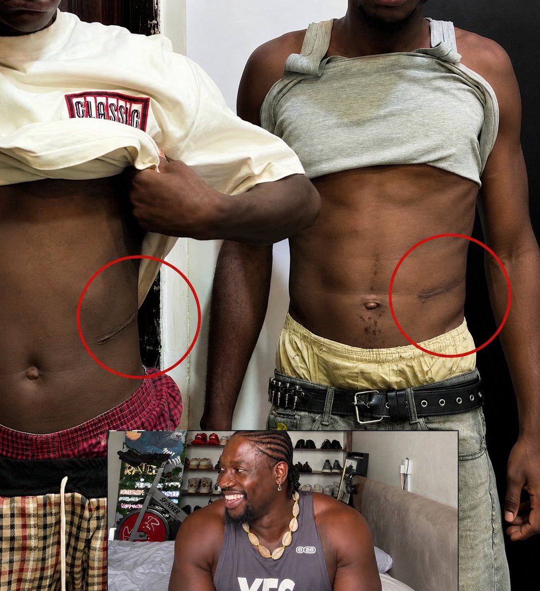 kenkenlewu's tweet photo. Update: The boy who claimed a Nigerian doctor removed his kidney. Investigation reportedly revealed that he had willingly agreed to sell it but wasn’t paid.

According to VDM, his friend lured him to the hospital, where the kidney was removed.

Police later arrested the friend and discovered that he was also missing his left kidney.

He reportedly confessed to selling his own kidney for ₦7m and later becoming an agent who lured others.

VDM claimed many people around Nyanya, Mararaba and Masaka may be walking around with one kidney.

He also said the suspect gave police the name of the hospital and the identity of the key agent allegedly behind the syndicate.

Me: But ₦7m is the cheapest price I’ve ever heard ooo. 😭

I thought kidney money was ₦20m above.