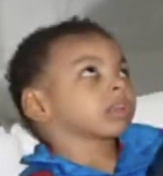 JamesDo55644296's tweet photo. @ohnonotapotato His brain stopped developing around 3 weeks

He’s 3 years old 

He stares up most of the time 

He could be partially blind and deaf

He has severe clubbed feet and restless leg syndrome

He is constantly folding his legs inward

He will never walk

He always makes the same noise https://t.co/e2AmyXWVEr