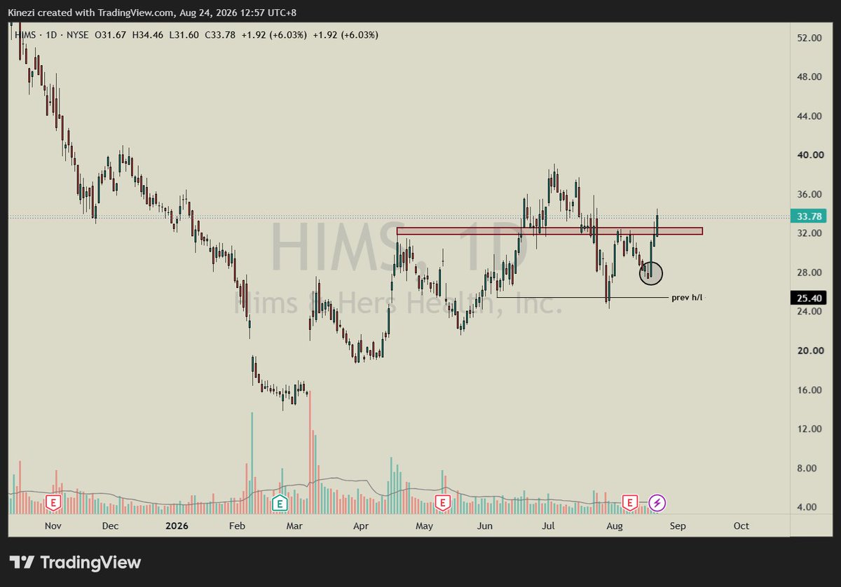 chilliwang02's tweet photo. $HOOD
$SOFI 
$HIMS https://t.co/bAKJKNBIBR