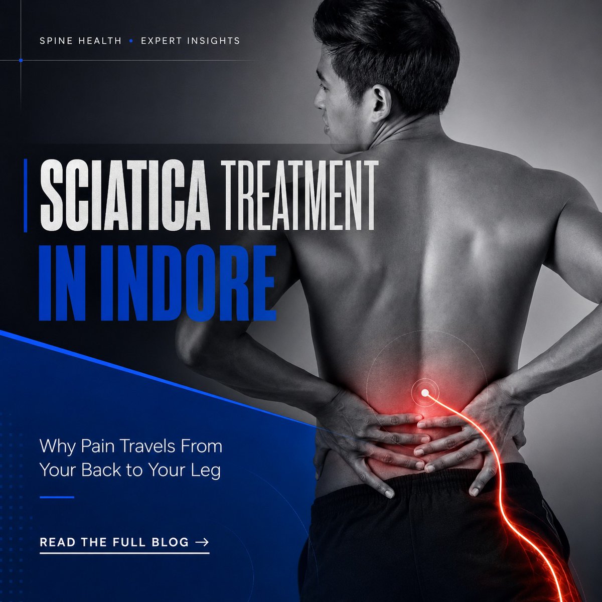 RaghuMewada002's tweet photo. Back pain that travels down your leg? It could be sciatica.

Understand why sciatica causes pain, tingling, or numbness &amp; how physiotherapy can support recovery with the right approach.

Read the latest blog.

#SciaticaTreatment #Physiotherapy

https://t.co/bM18o0mOKi https://t.co/DuOLljYagf