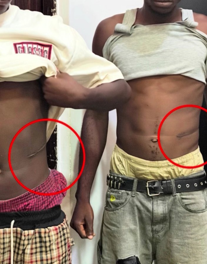 mamba90774's tweet photo. Young people sell their kidney now to survive in Nigeria ?

What’s going on in this country ‼️🤦🏿 https://t.co/Euo2tDRhNE
