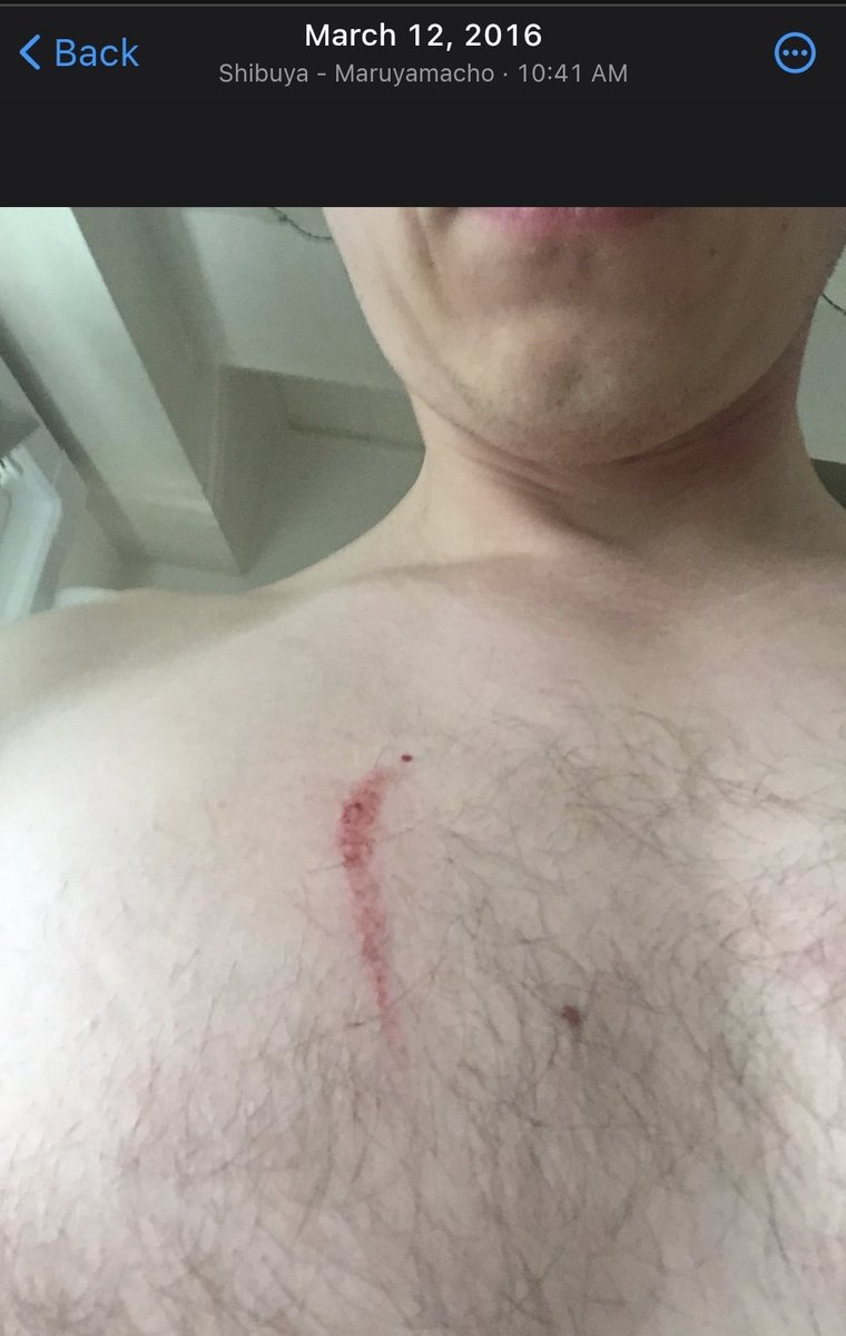 kgonciarz's tweet photo. Katarzyna Mecinski stosowała na mnie przemoc fizyczną podczas związku od 2015 roku. 
Po rozstaniu w 2018 roku latami stosowała przemoc psychiczną, osaczanie, gaslighting i manipulację. Stosowata przemoc finansową, odmawiając mi wynagrodzenia za pracę.
Kiedy w 2023 roku wyczuła, że statem się silniejszy i nie reaguje w przewidywalny dla nie sposób, skontaktowała się z Darią Dabrowską i dała jej moje prywatne rozmowy i informacje o mnie, które doprowadziły do mojego
fałszywego calloutu w czasie Pandora Gate. 
Od tamtego czasu latami mnie pomawiała, nasyłając na mnie gang kretynek i hejterek. Mecinski ukradła własność intelektualna naszej spółki i zdefraudowała iej majatek
Jei próba zainiciowania procedury zakazu zbliżania w USA zmierzała do uciszenia mnie.
Niech już zawsze Katarzyna Mecinski będzie twarzą przemocy wobec mężczyzn i przemocy domowej.