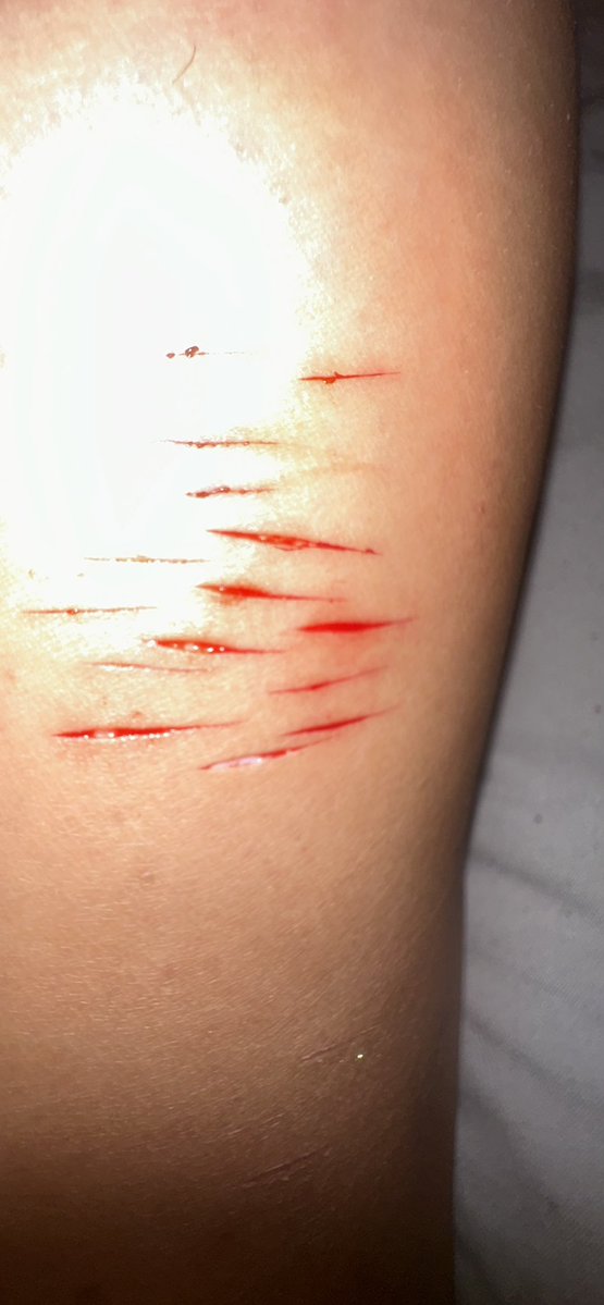 sharm808's tweet photo. Yummy
SFX MAKEUP!!! FAKE!!!

#slittwt #shtwt https://t.co/S2YxcPNB9h