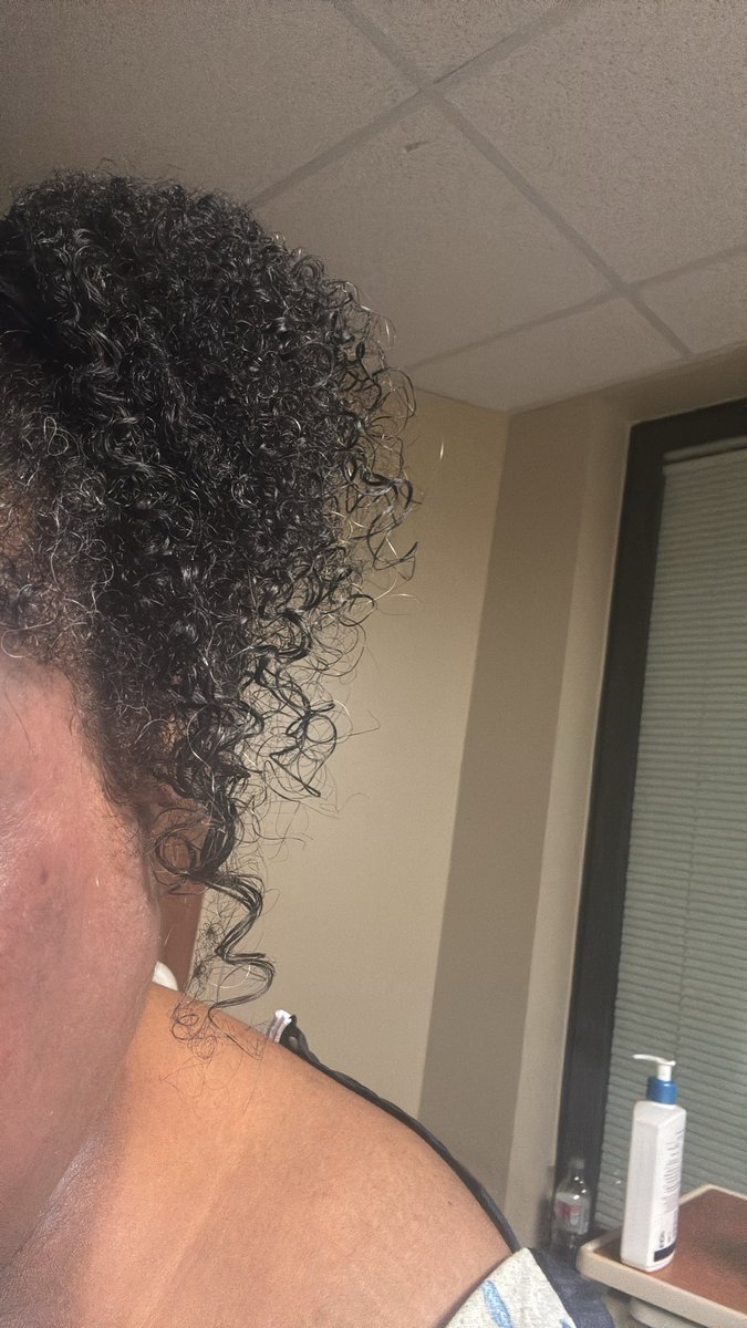 Babymetalspice's tweet photo. Shrinkage and hyperpigmentation aside, she’s poppin #curlyhairdontcare https://t.co/pt9fshdN19