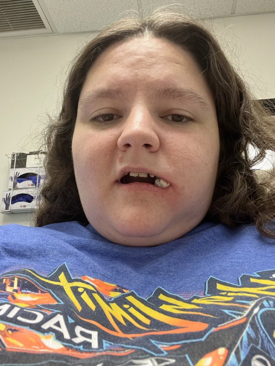CrystalMan25367's tweet photo. Sorry guys I haven’t been active I got 2 wisdom teeth pulled so I have been resting and recovering https://t.co/IkTgBCrVvA