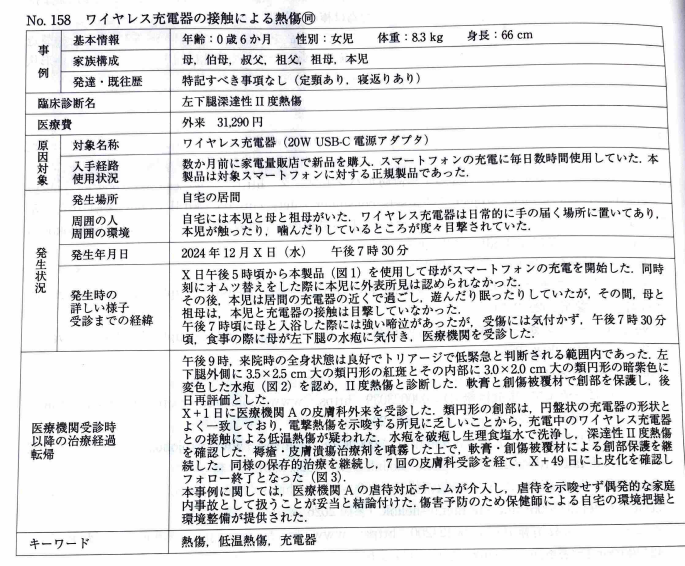 AoringoDr's tweet photo. ⚠️【注意喚起】スマホを置くだけで便利な「ワイヤレス充電器」。実はこれで、赤ちゃんが深いヤケドを負う事故が報告されています。

Injury Alert No.158：ワイヤレス充電器の接触による熱傷

●発生状況
・0歳6ヶ月の赤ちゃんがリビングで過ごしている間、床のワイヤレス充電器に足が触れ続けていました。
・夜に水ぶくれに気づいて受診したところ、充電器と同じ「丸い形」の深いヤケド（低温熱傷）を負っており、治るまでに1ヶ月半以上かかっています。

●なぜヤケドするの？🤔 
・ワイヤレス充電は、スマホと位置がズレたりすると想定外に熱くなることがあります。
・「少し熱いな」程度でも、長時間触れると低温熱傷に。特に赤ちゃんは不快でも自分から逃げられないため、気づかないうちに重症化しやすいんです。

●今日から見直したい予防策 🍎 
① 子どもの手が届かない場所（高いところ等）で充電する
② 充電後はコンセントに挿しっぱなし・置きっぱなしにしない
③ 布団や枕など、熱がこもる場所で使わない
④ 安全基準を満たした「Qi認証」の製品を選ぶ

特に、ハイハイや寝返りをする時期のお子さんがいるご家庭は特に要注意です。大切な子どもたちを事故から守るため、ぜひ周りのパパ・ママにも教えて下さい！