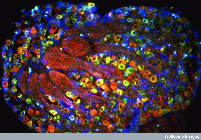 dr_robinmalloy's tweet photo. ❤️🔥🧪🧬🦠🔬 WONDERFUL NEURONS
Section through a neonatal dorsal root ganglion (DRG) showing the cell bodies of different populations of sensory nerves.
CIL:38965*
#Nature #cells #Neuroscience
#brain #kosmos #Creation
#quantum #mind #Biochemistry
#proteins https://t.co/cRVZvv9JXj