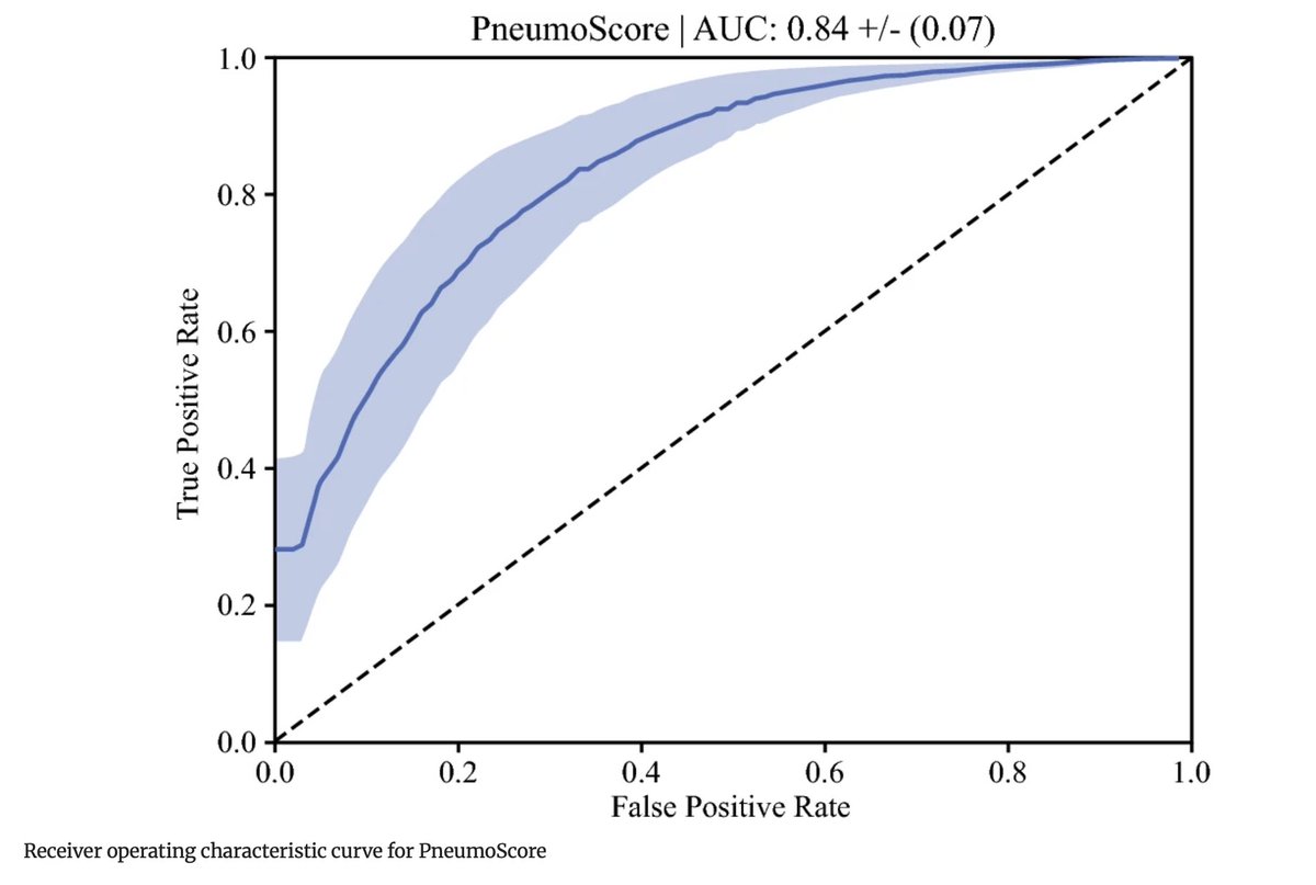 AnnSurgOncol's tweet photo. August Issue: PneumoScore: Risk Prediction Model for 90-Day Mortality After #LungResection
https://t.co/n79GOlEuBd
@ZaidAbdelsattar
@SyedAAhmad5
@SocSurgOnc https://t.co/XcYyB1dTVU