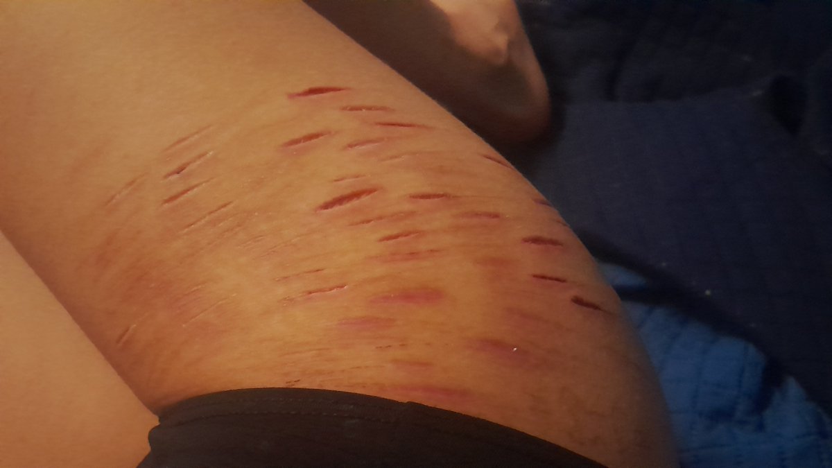Im_CosmicBerry's tweet photo. Una fotito antigua de mk maquillaje profesional jiji ^_^ #sh #fakebody #shttwt #selfharm https://t.co/IyYC5VNtWU