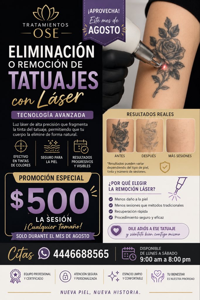 MasajesOsec3's tweet photo. El retiro de tatuajes con láser de picosegundos utiliza pulsos ultracortos de energía para pulverizar la tinta en partículas microscópicas.
#retirodetatuaje #queretaro #eliminaciondetatuajequeretaro #queretaro #remociondetatuajequeretaro
https://t.co/6Jd60jYq2e o 4446688565 https://t.co/btrykssEyR