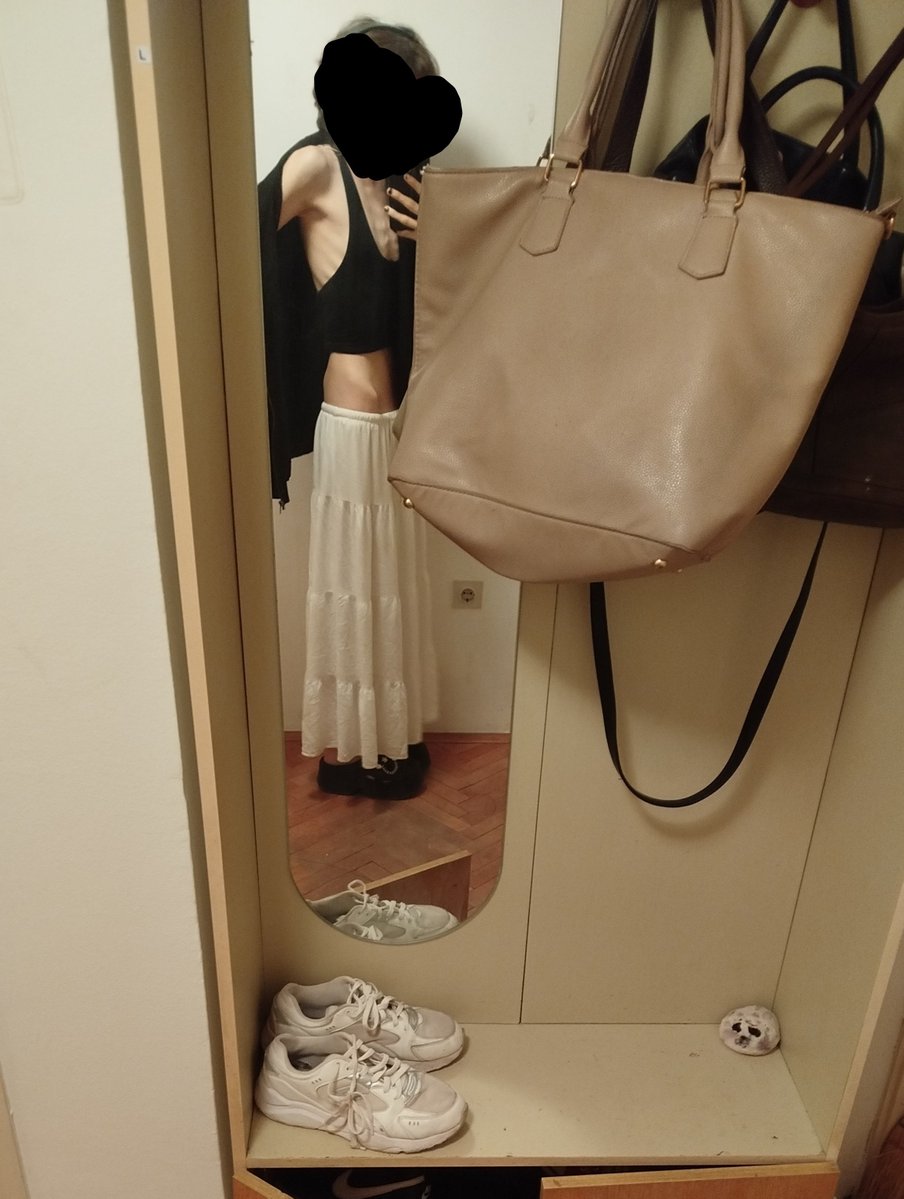 gloomifawn's tweet photo. 38.7kg 173cm bc +arm bc 
im exhausted n still feel like I need to los more
#edrtwtㅤ #shedrtwt #bc #spo https://t.co/IY0esB8fkS