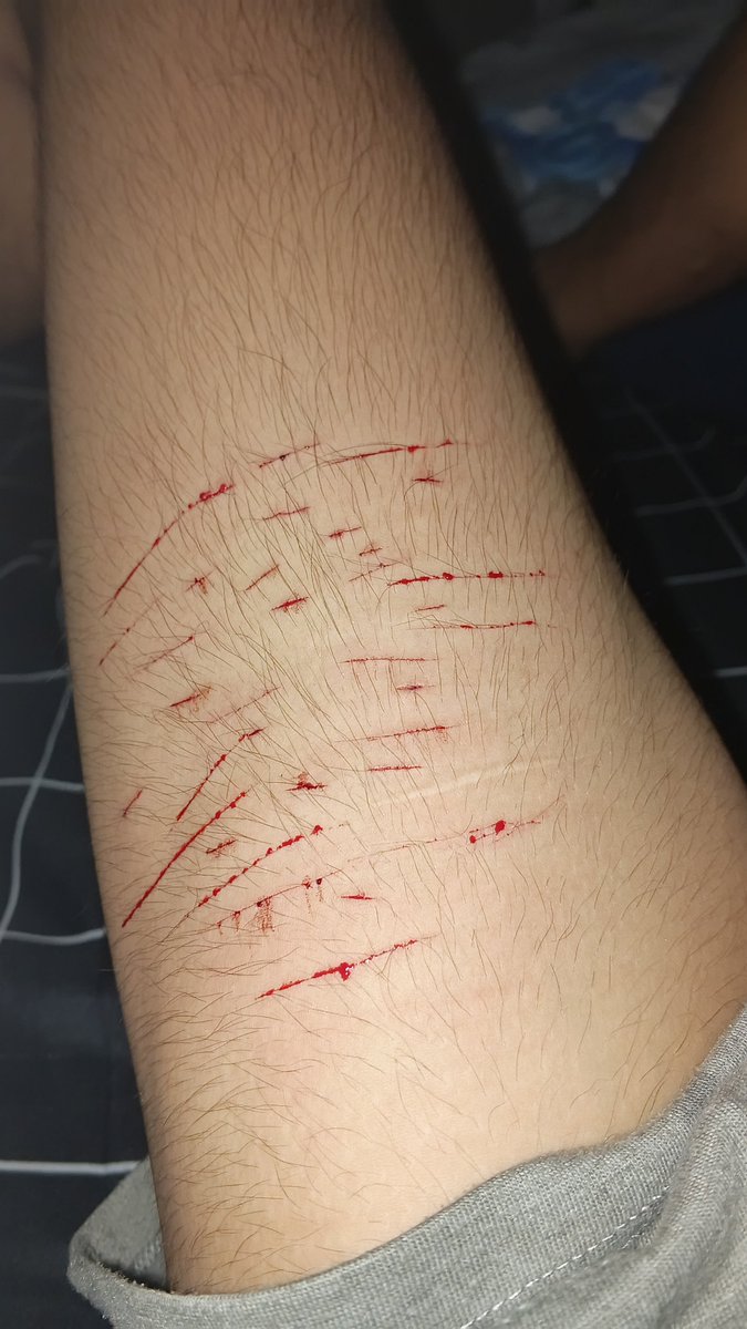Wnterlude's tweet photo. HOLY SHTTTT https://t.co/gRCuM38lIS