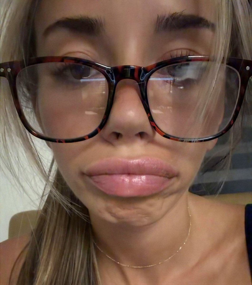 relapse2brats's tweet photo. mommy is sick today any of u goontards gonna come make her feel better? 😘#wankchat #nsfwtwtًً https://t.co/uvN922Nb7X
