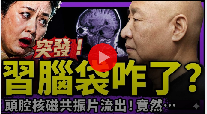 RuoXi56517's tweet photo. 💥⚡️習近平大腦MRI影像流出！醫生：颅腔滿滿啥玩意？山東臨沂大bao炸，中共入同歸於盡時代？遼寧公安：
大獻中真相來了！https://t.co/aQ0B1yA0Bl https://t.co/oKzsht9PGV #老北京茶馆 https://t.co/I5LWFtTyPJ