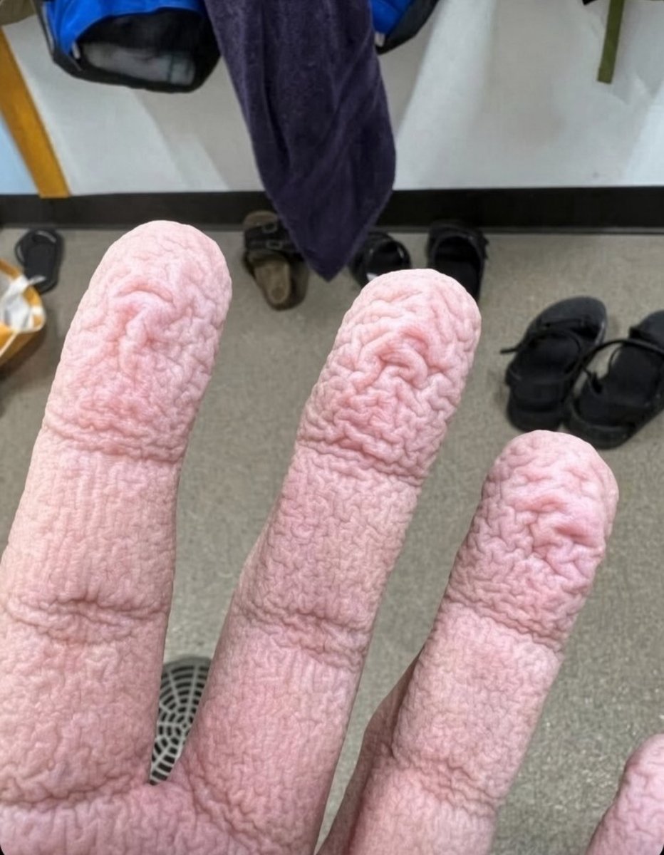 JermaineChowder's tweet photo. This is my hand after some fun, https://t.co/fwYohDFLdt