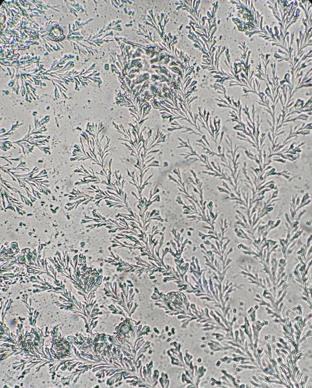 Rainmaker1973's tweet photo. Vaginal secretions viewed under a microscope https://t.co/Z6aivZeGu8