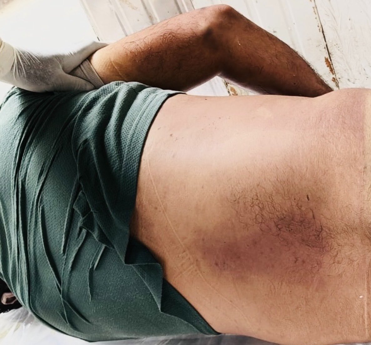DepanshuMalikFD's tweet photo. My brother was admitted to a rehab(Vishal Foundation) in Chandausi on Aug 3 for de-addiction. On Aug 6, he died &amp; post-mortem shows 17 wound marks. Staff dumped his body at Meerut Hospital &amp; fled. We have been running b/w police stations, but officials aren’t even lodging an FIR. https://t.co/olcWOypCdT