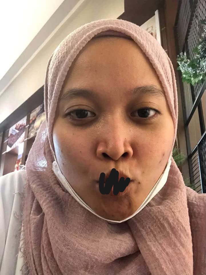 nrlhudaadam's tweet photo. POV: after vs before 😭 jom i spill daily skincare routine i ✨ https://t.co/Wg8babtmrO