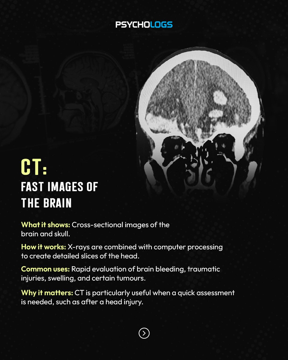 PsychologsIndia's tweet photo. How do researchers study the brain without directly seeing it at work?
X-ray, CT, MRI, MRA, and PET each have a specific role in understanding brain structure and function.
#BrainImaging #Neuroscience #BrainHealth #Neuroimaging #Psychology #Neurology #MRI #CTScan #PETScan https://t.co/GlVchPzETu