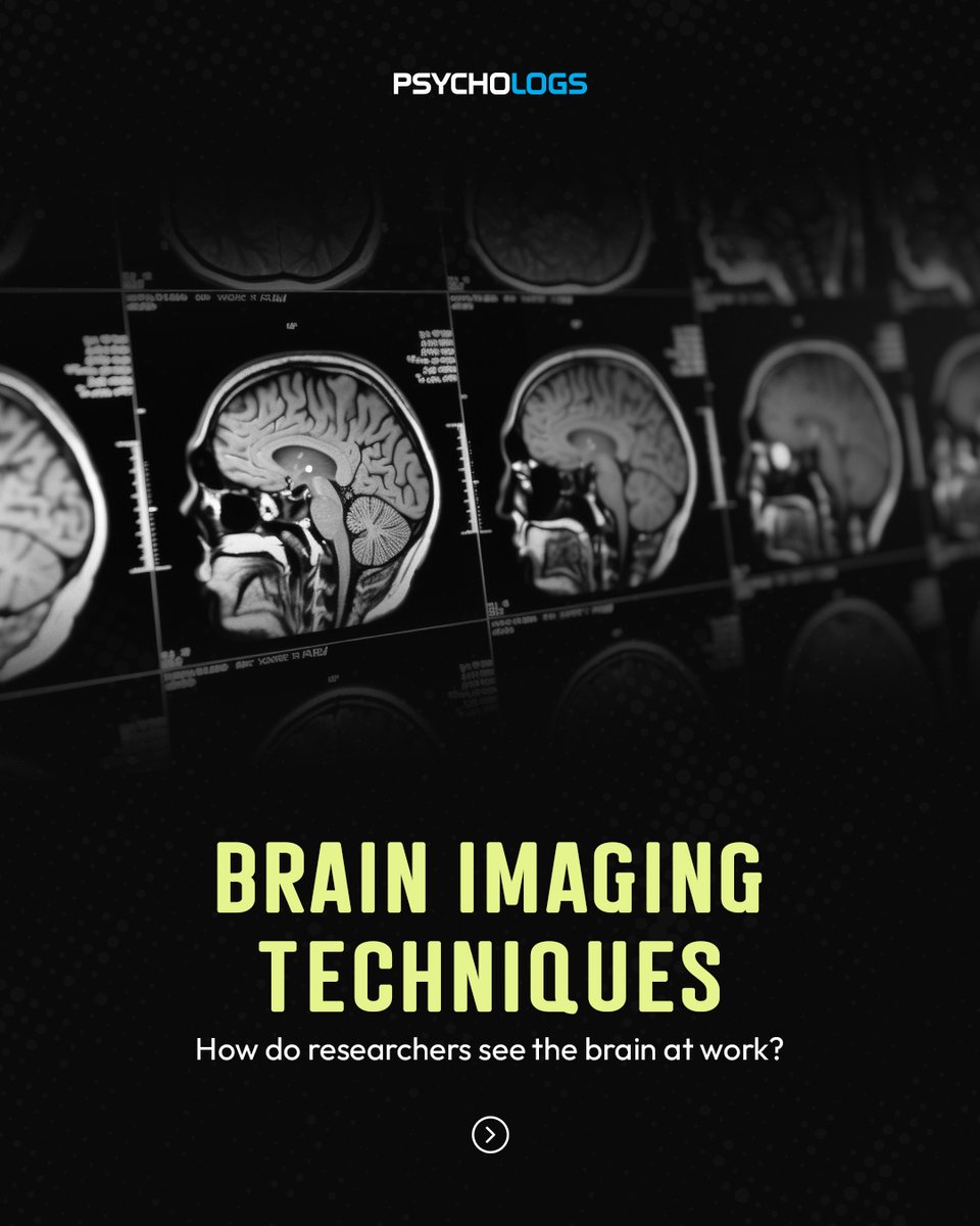 PsychologsIndia's tweet photo. How do researchers study the brain without directly seeing it at work?
X-ray, CT, MRI, MRA, and PET each have a specific role in understanding brain structure and function.
#BrainImaging #Neuroscience #BrainHealth #Neuroimaging #Psychology #Neurology #MRI #CTScan #PETScan https://t.co/GlVchPzETu