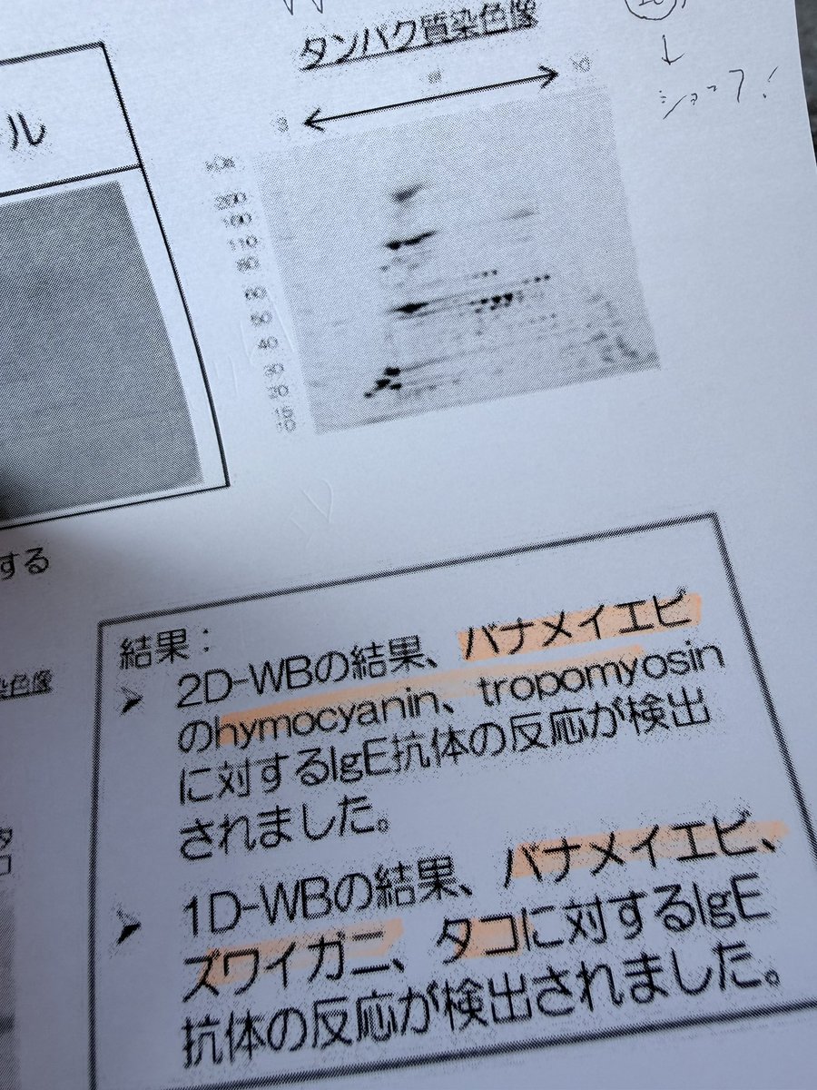 hitoneko_'s tweet photo. パッチテストでも反応してたけど、血液検査でもバッチリ出てしまって😭
たこもダメだった😭

でも🦑食べちゃってるワタシ😋
この間北海道でホタテ食べたけどって主治医に言ったら、危険⚠️って脅された。
海鮮系食べられなくなっちゃうのかなー、つら！！ https://t.co/WKoFTGAPus