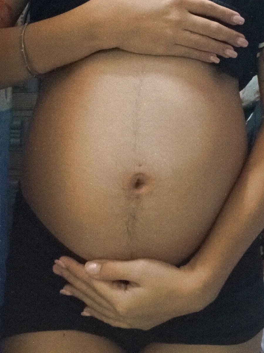 iambule_'s tweet photo. Thankyouu po lord sa blessings!!
IT'S A GIRL!!👶🏻🩷
HIRAYA HEART TRABALLO 🩷
Thankyouu palagi anak kasi dimo pinapahirapan si mama sa work, i love you baby girl ko!! https://t.co/8mXHhbW47D