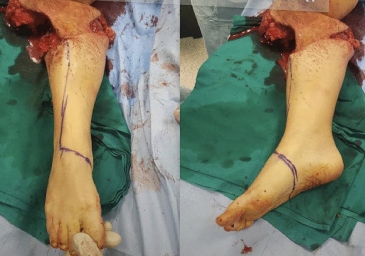 mintbunniess's tweet photo. Before and after
Ai medical school practice art ai sfx makeup cosplay prop #Goretwt https://t.co/fZmXWZYrZQ